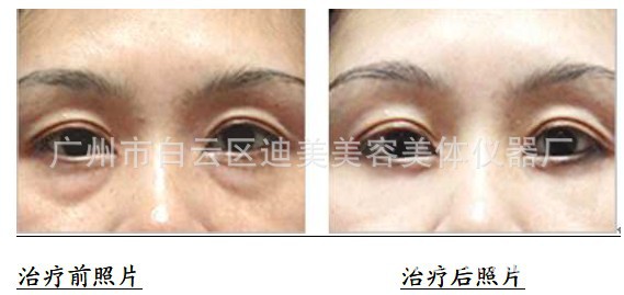 美容儀