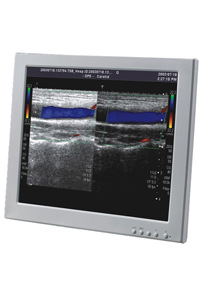 LCD系列产品-JDI 17寸 SXGA IPS工业医疗屏