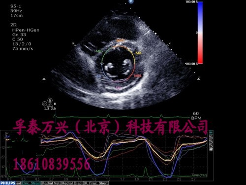 Cardiology quantificatio<em></em>n_co<em></em>ne