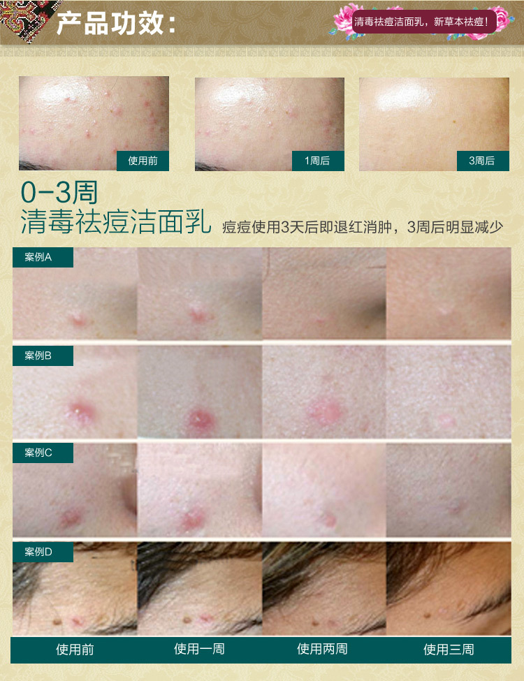 清毒潔面膏7