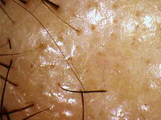 【最新500万像素专业<em>头发</em>头皮测试仪,<em>头发检测</em>