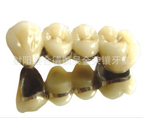 【商业服务 优质陶瓷牙 以质为本 诚信立足】价