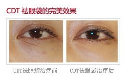 CDT微整形機器人