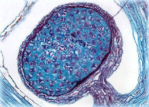 lycopodiumstrobilus20xlarge