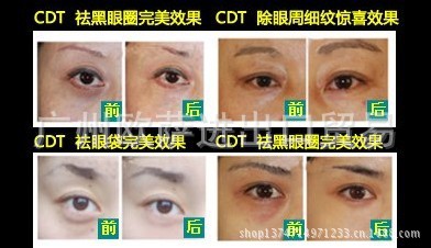 CDT微整形機器人4