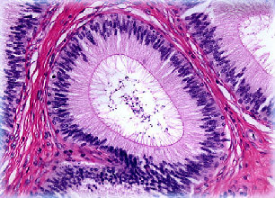 epididymis20xlarge