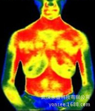 红外热像仪用于疾病辅助检测