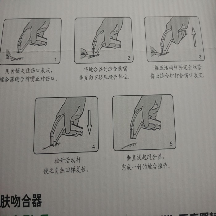 皮肤缝合器_皮肤缝合器 缝合针 皮肤吻合器 拆钉灭菌 ...