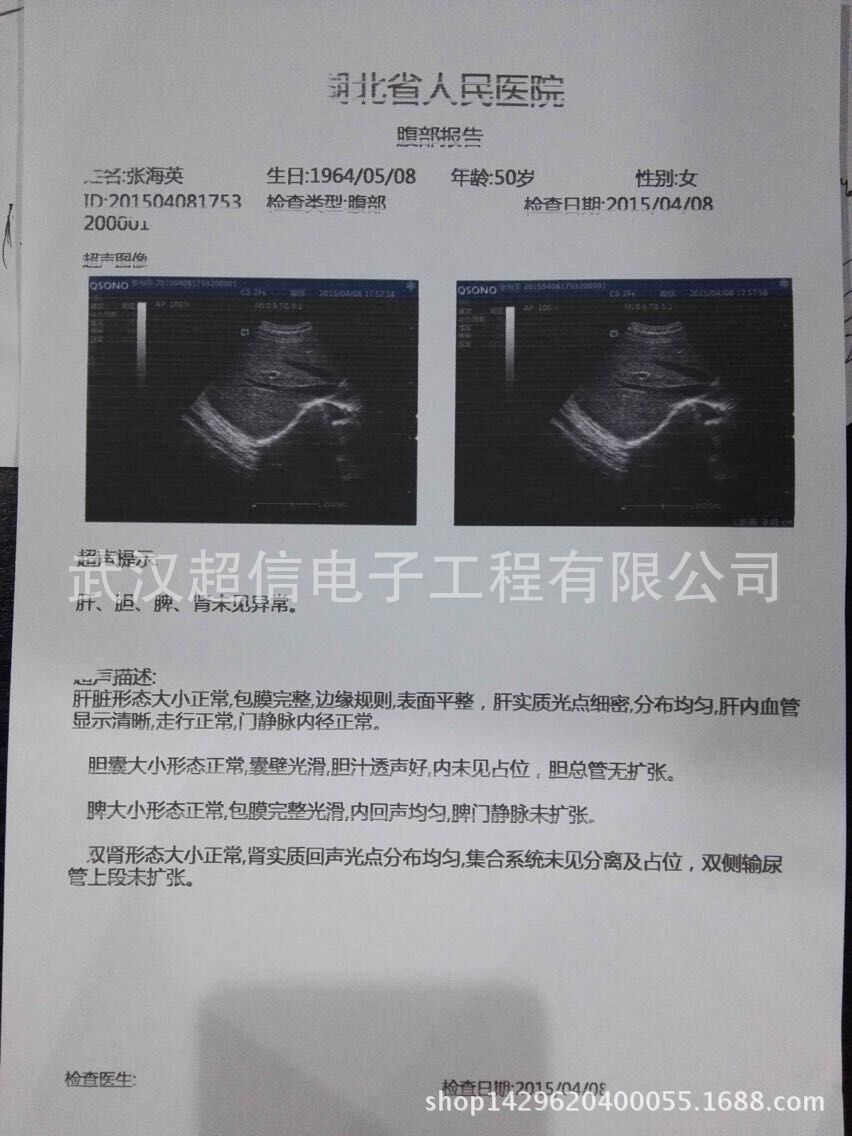 QQ图片20150408204948