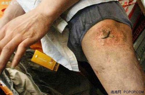 ����ֻ��ᱬը����ȷʹ�þܾ����˺� ���� �ֻ� ��Ѷ ��ҵ��Ѷ 