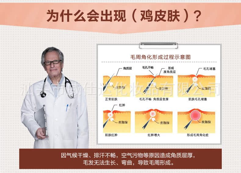怎么区分鸡皮肤和毛囊炎(怎么区分鸡皮肤和毛囊炎图片) 怎么区分鸡皮肤和毛囊炎(怎么区分鸡皮肤和毛囊炎图片)