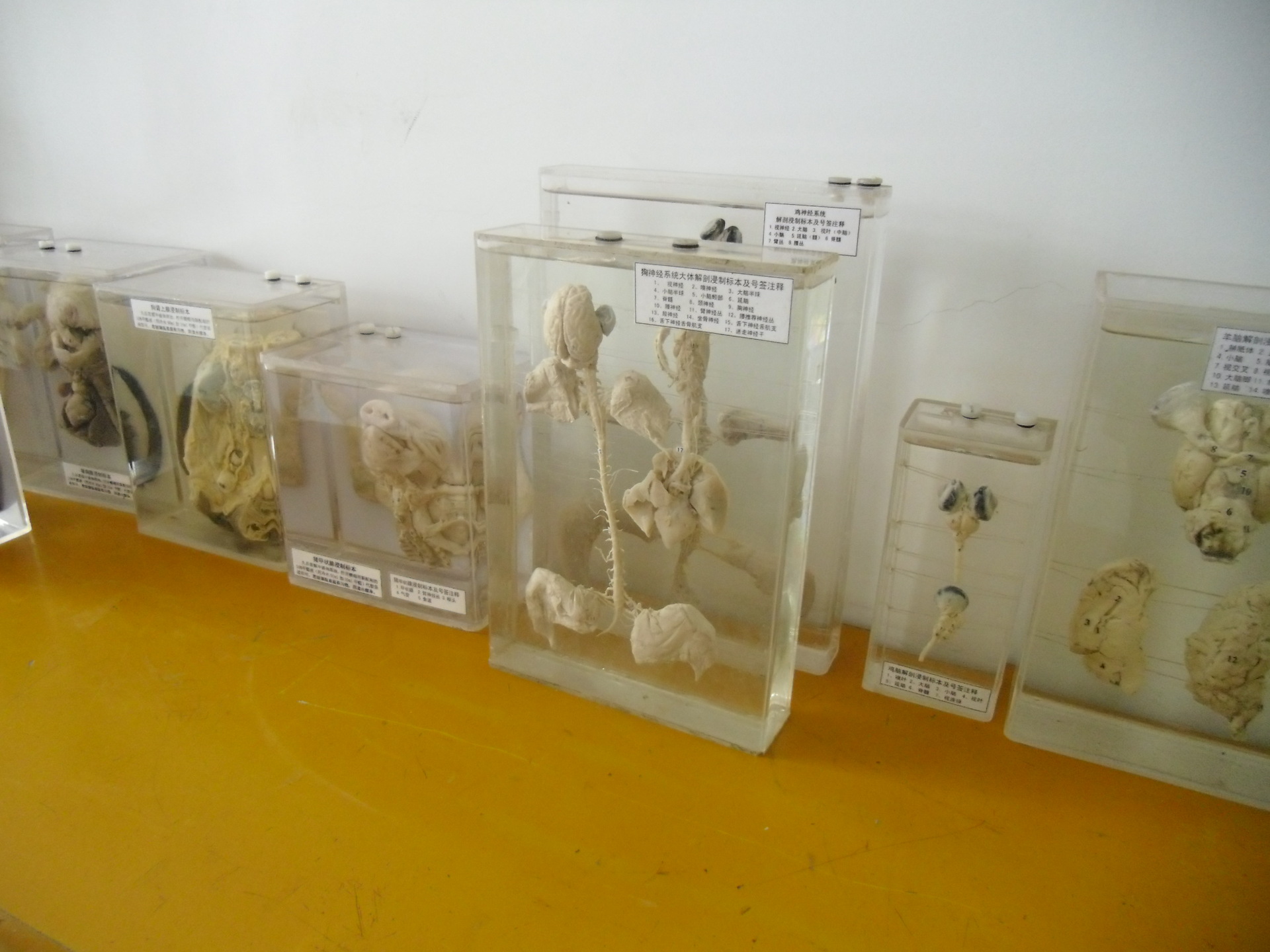 漯河风帆医学 侵袭性神经纤维瘤 病理大体